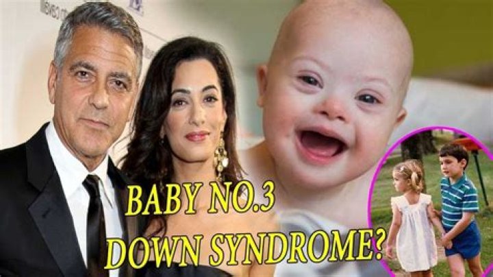 Unveiling The Facts: George Clooney's Son And Down Syndrome
