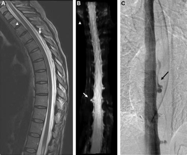 Mitigating Kornkernal Leaks: A Comprehensive Guide